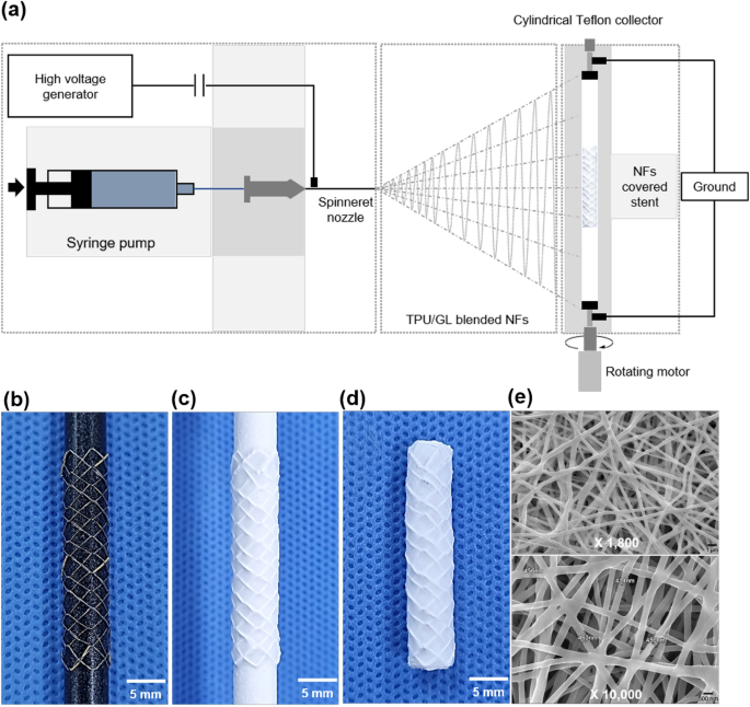Efficacy of thermoplastic polyurethane and gelatin blended nanofibers covered stent graft in the porcine iliac artery | Scientific Reports