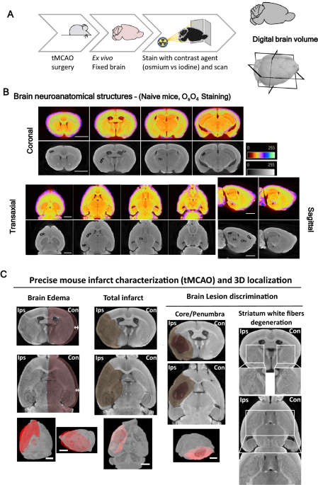 High-resolution micro-CT for 3D infarct characterization and segmentation in mice stroke models | Scientific Reports