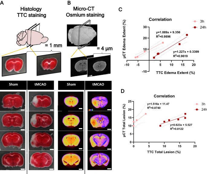 High-resolution micro-CT for 3D infarct characterization and segmentation  in mice stroke models