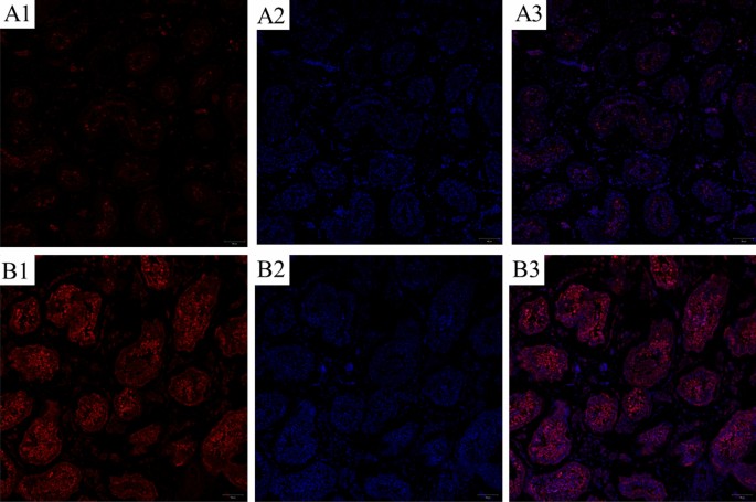VASA protein and gene expression analysis of human non-obstructive azoospermia and normal by immunohistochemistry, immunocytochemistry, and bioinformatics analysis | Scientific Reports
