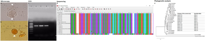 Subtypes and phylogenetic analysis of blastocystis sp. Isolates from west ismailia, egypt