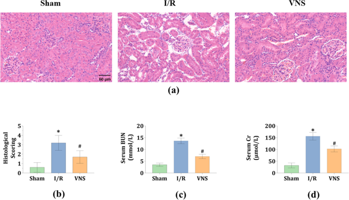 glutathione iv aml Glutaredoxin 2 is essential for AML survival through mitochondrial  permeability transition pore regulation