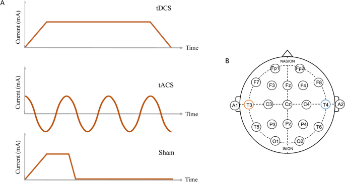 What's The Difference Between tDCS & tACS?