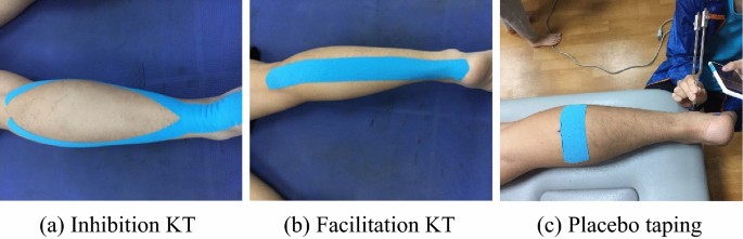 Effects of the direction of Kinesio taping on sensation and postural  control before and after muscle fatigue in healthy athletes