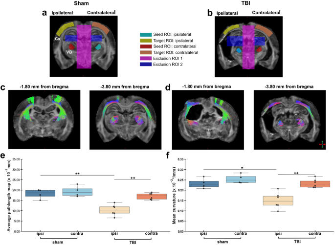 Diffusion Tensor Imaging in Traumatic Brain Injury