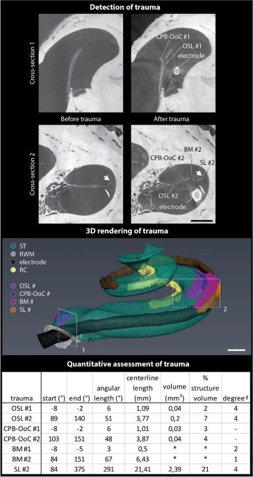 Contrast‐enhanced micro‐computed tomography of compartment and