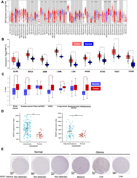 Systematic analysis identifies REST as an oncogenic and immunological  biomarker in glioma