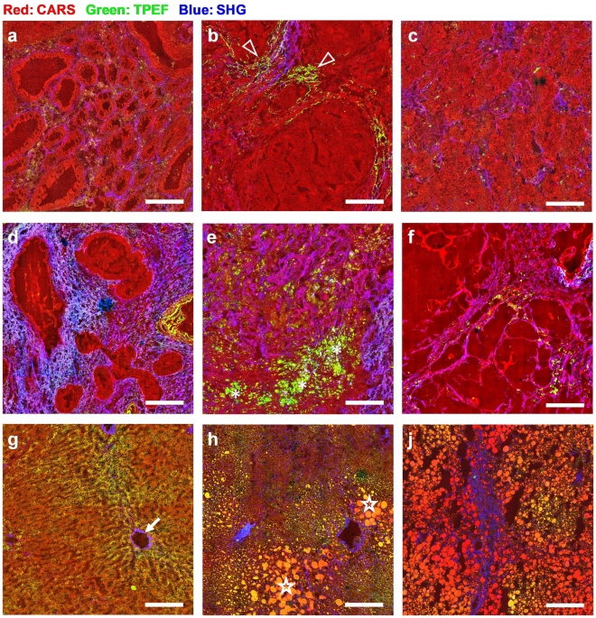 Automated liver tissues delineation techniques: A systematic