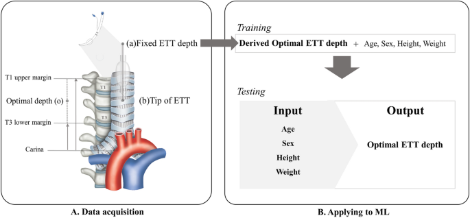 Predicting the risk of inappropriate depth of endotracheal 