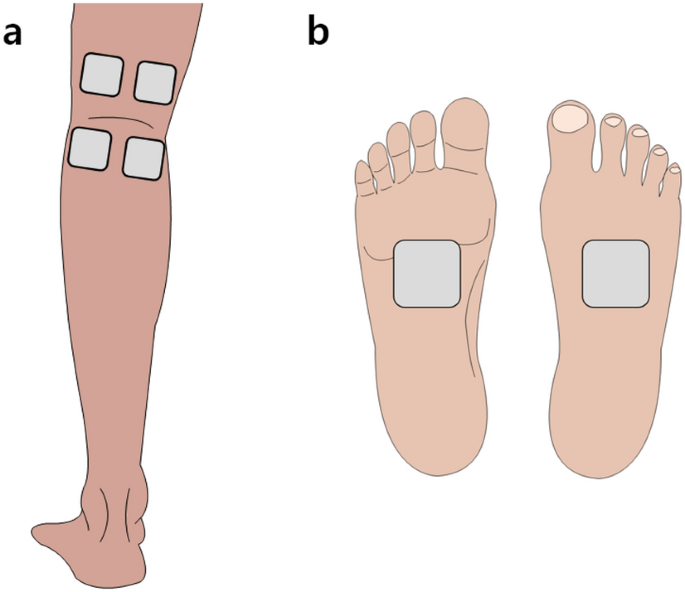 22. HOW TO USE A TENS UNIT WITH FOOT PAIN (TOP, HEEL, PLANTAR FASCIITIS)  CORRECT PAD PLACEMENT