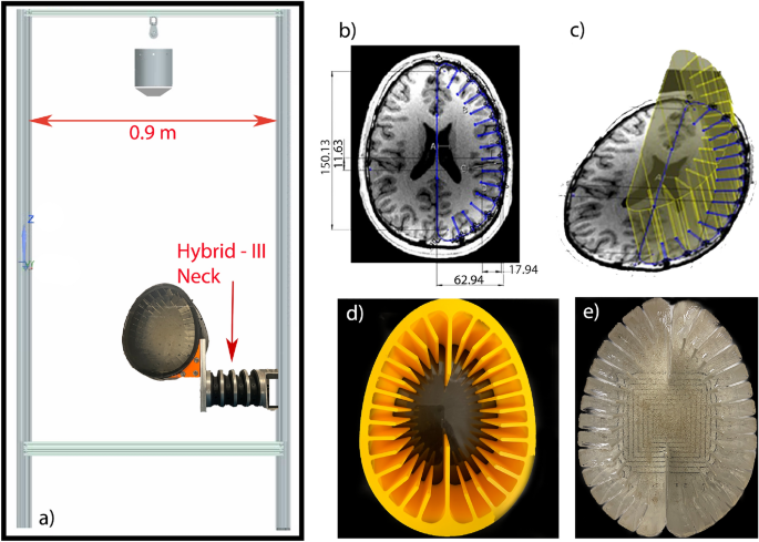 Measuring vibrations on a biofidelic brain using ferroelectret  nanogenerator