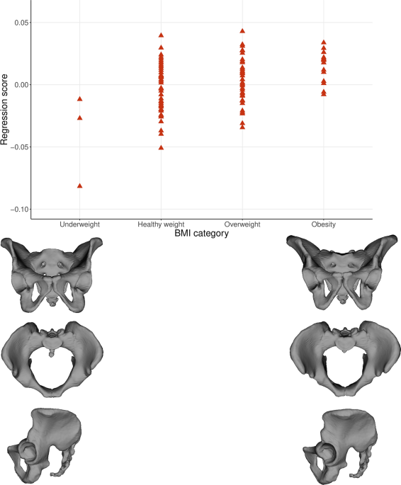Changes in plasticity of the pelvic girdle from infancy to late