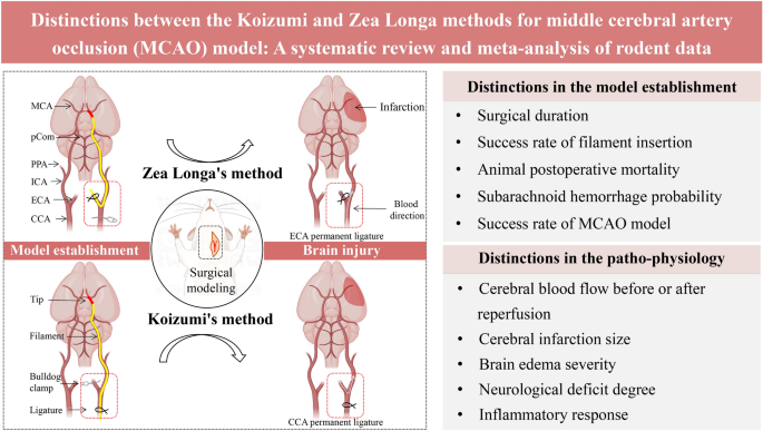 Cerebellar Artery - an overview