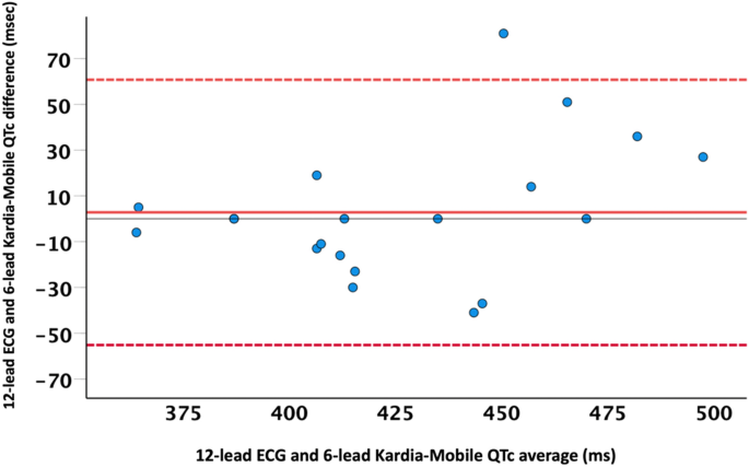 The KardiaMobile Card Review: Accurate ECG Recording and Analysis