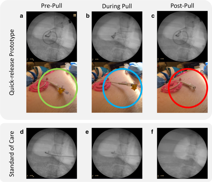 Abdominal Drain Care 