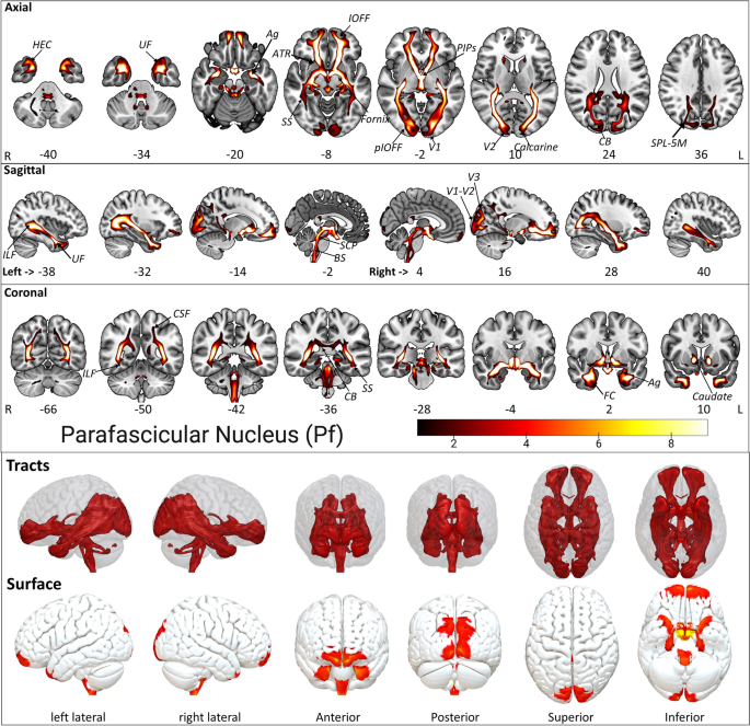 PDF) Tractographical model of the cortico-basal ganglia and corticothalamic  connections: Improving Our Understanding of Deep Brain Stimulation