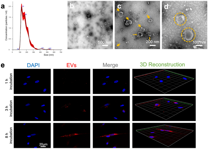 Evaluation of in vitro biocompatibility of human pulp stem cells with allogeneic, alloplastic, and xenogeneic grafts under the influence of extracellular vesicles