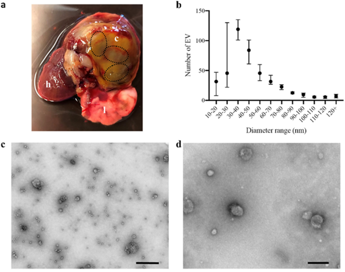 The proteome of extracellular vesicles of the lung fluke Paragonimus  kellicotti produced in vitro and in the lung cyst | Scientific Reports