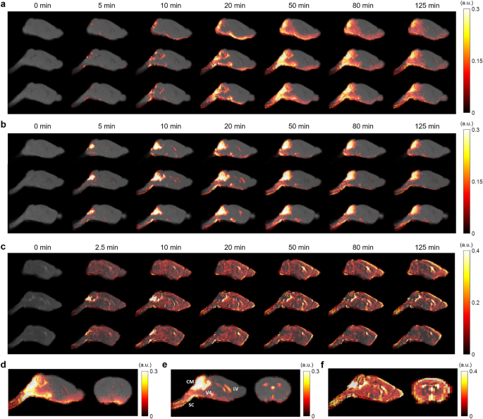 Fluid transport in the brain