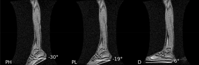 Effect of different ankle joint positions on medial gastrocnemius muscle fiber strains during isomet