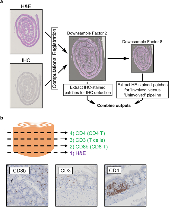 Computational immunohistochemical mapping adds immune context to 