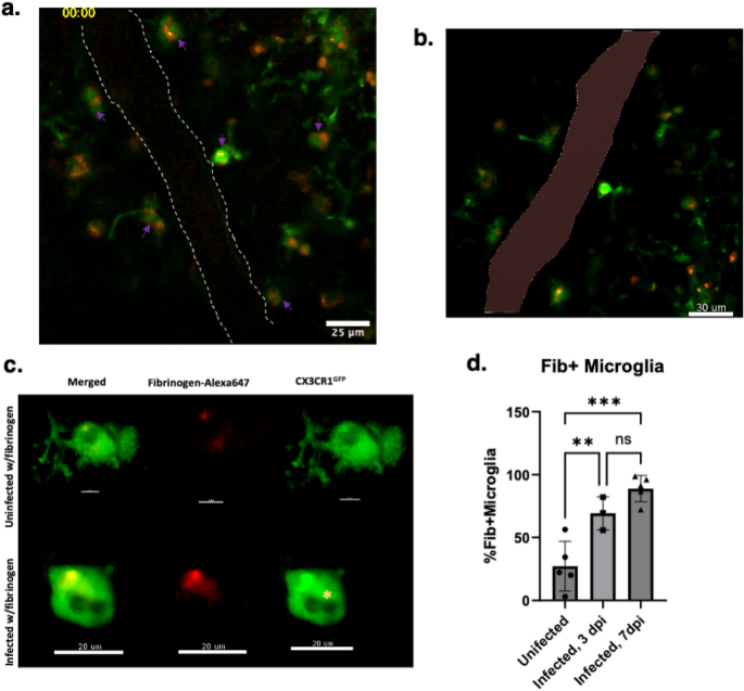 Dynamic intravital imaging reveals reactive vessel-associated microglia  play a protective role in cerebral malaria coagulopathy