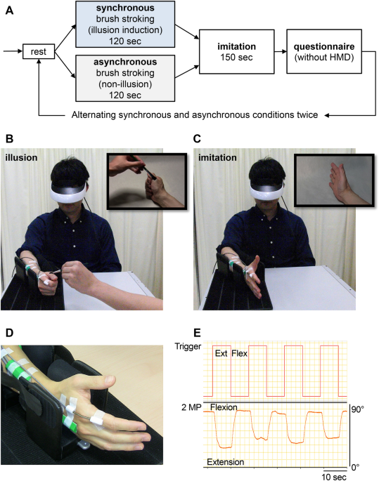 Facilitation of imitative movement in patients with chronic 