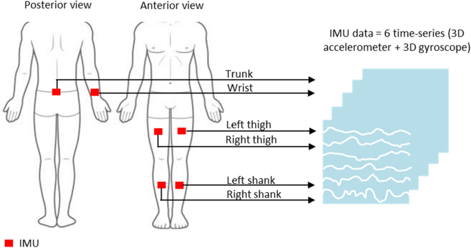 Minimum number of inertial measurement units needed to identify significant  variations in walk patterns of overweight individuals walking on irregular  surfaces