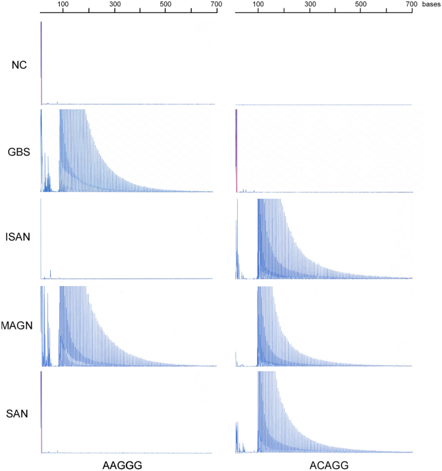 Canvas-related rfc1 mutations in patients with immune-mediated neuropathy