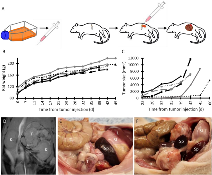 Survival following complete resection of neuroblastoma in novel 