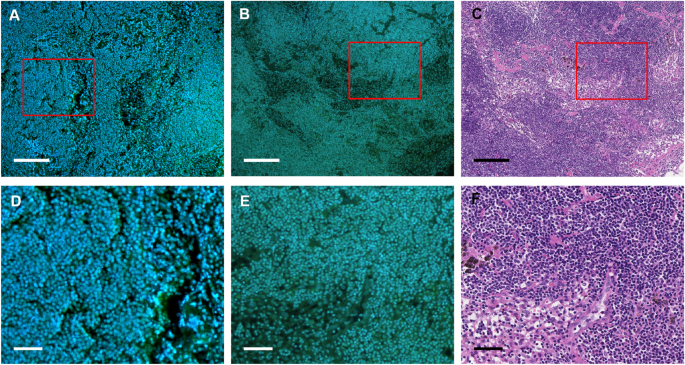 Deep UV-excited fluorescence microscopy installed with CycleGAN-assisted image translation enhances precise detection of lymph node metastasis towards rapid intraoperative diagnosis