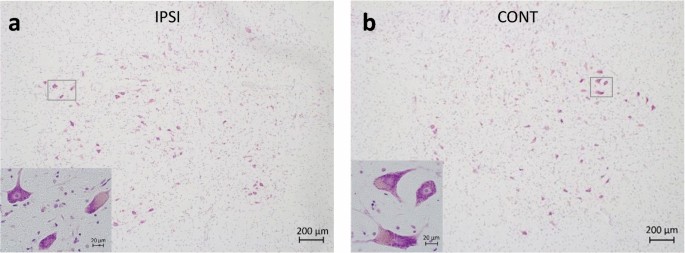 Early histopathological changes of secondary degeneration in the 