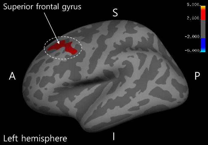 スピーク・アップ・ストーリーズ　No.212-247 12 Barriers to Learning \u0026 Strategies to Overcome Them スピーク