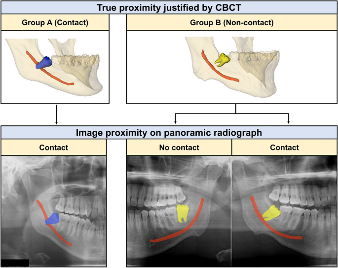 Automatic diagnosis of true proximity between the mandibular canal 