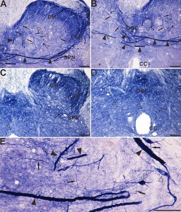 De novo aging-related nadph diaphorase positive megaloneurites in the sacral spinal cord of aged dogs