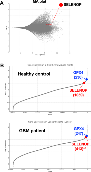 hikari glutathione manufacturer Selenoprotein P expression in glioblastoma as a regulator of ferroptosis sensitivity: preservation of GPX4 via the cycling-selenium storage Brighten Dark Underarms with C-KACKIEAOS-D-100 Pack size:Pack of 2 (Most Popular)