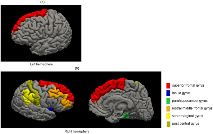 Correlation between frailty and reduction in cortical thickness in 