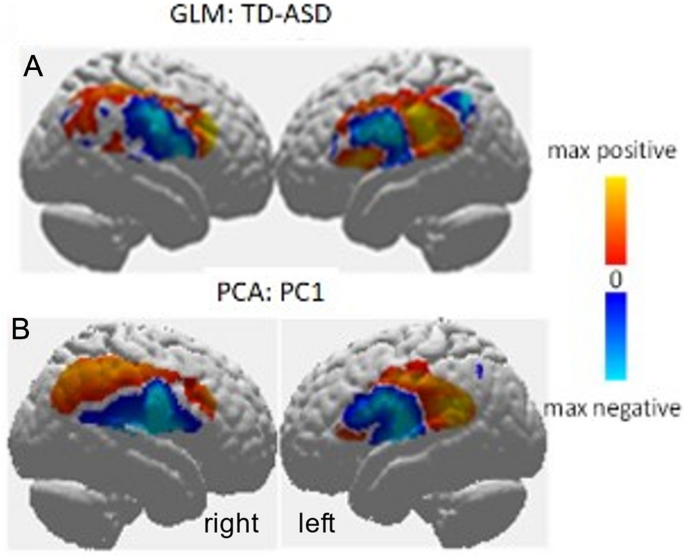 Support vector machine prediction of individual Autism Diagnostic Observation Schedule (ADOS) scores