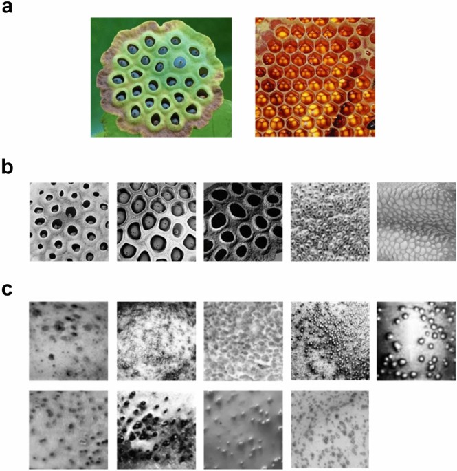 Trypophobia, skin disease, and the visual discomfort of natural 