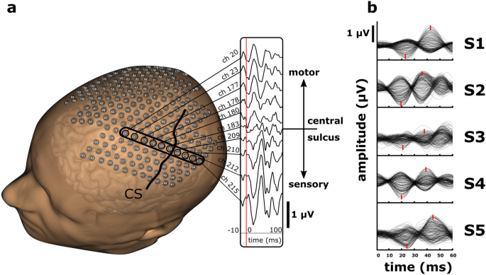 Mapping of the central sulcus using non-invasive ultra-high 