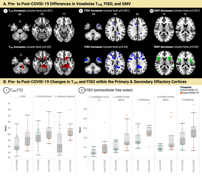 Brain temperature and free water increases after mild COVID-19 infection | Scientific Reports