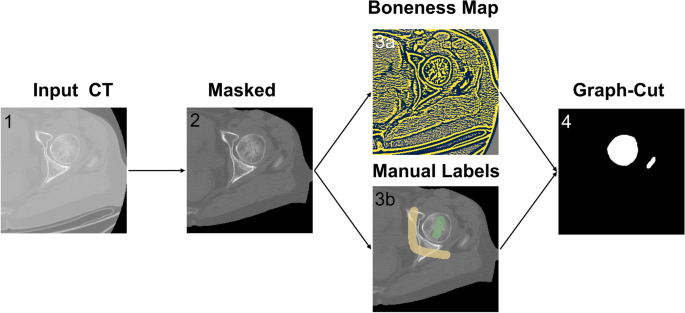 Development and validation of a semi-automated and unsupervised 