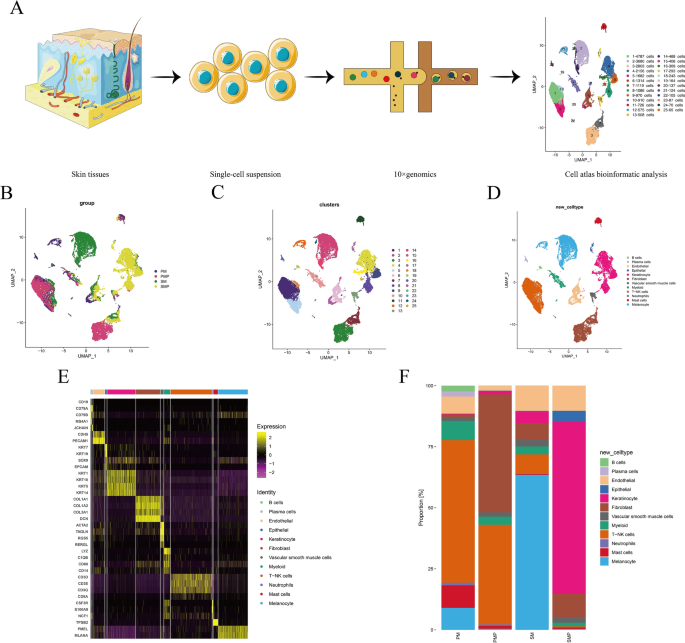 Single-cell rna sequencing unveils tumor heterogeneity and immune microenvironment between subungual and plantar melanoma