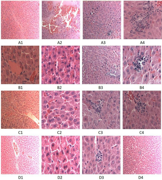 Effects of isorhamnetin on liver injury in heat stroke-affected rats under dry-heat environments via oxidative stress and inflammatory response