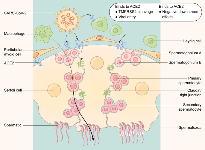 Systematic analyses of the factors influencing sperm quality in patients with SARS-CoV-2 infection |