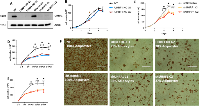 The E3 ubiquitin-protein ligase UHRF1 promotes adipogenesis and  