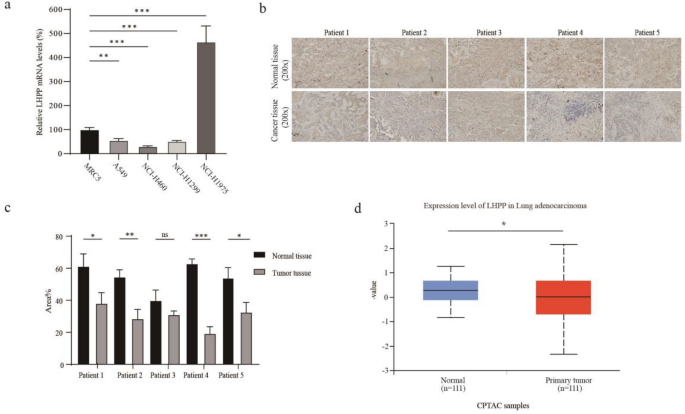 Oncolytic adenovirus encoding LHPP exerts potent antitumor effect in lung cancer