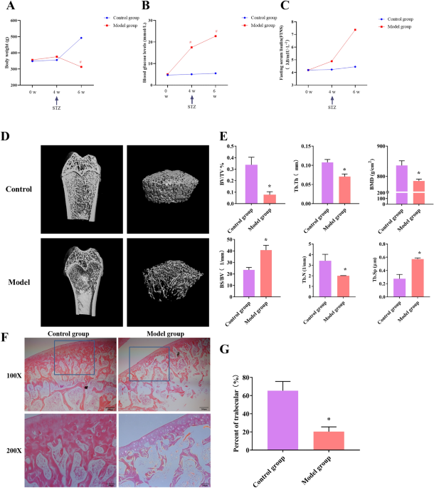 miRNA-seq analysis of high glucose induced osteoblasts provides insight into the mechanism underlyin