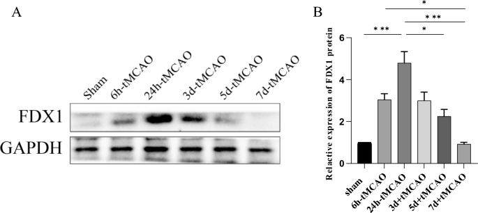 Disulfiram downregulates ferredoxin 1 to maintain copper homeostasis and inhibit inflammation in cerebral ischemia/reperfusion injury