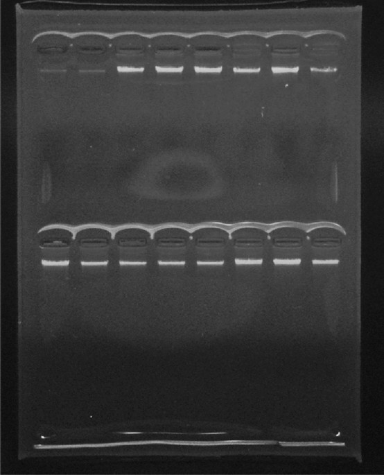 bpc 157 dosage calculator female pdf Stable Gastric Pentadecapeptide BPC 157 Therapy for Monocrotaline-Induced  Pulmonary Hypertension in Rats Leads to Prevention and Reversal